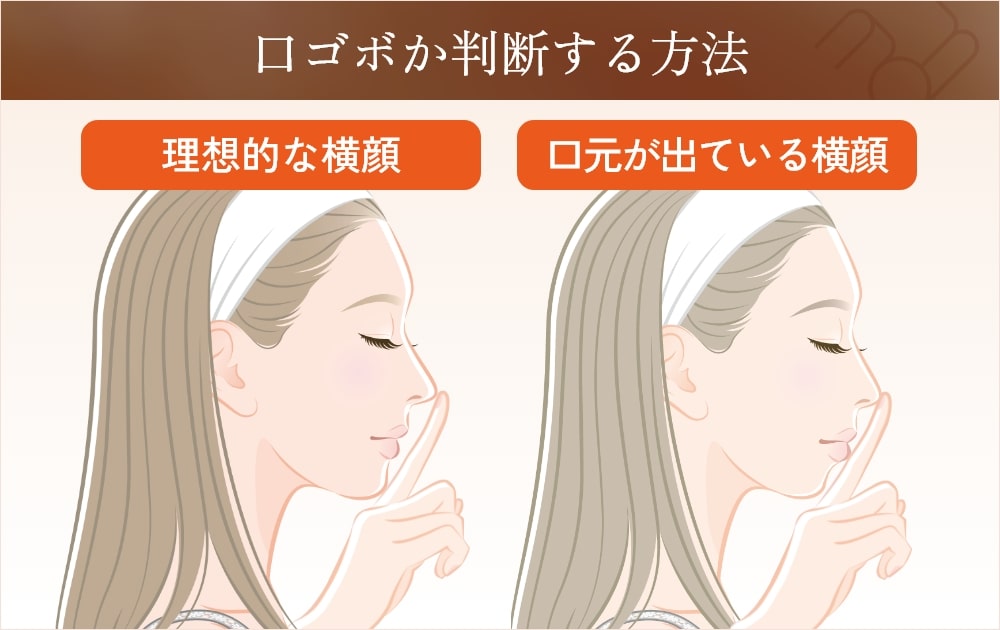 口元の出ている横顔と理想的な横顔の比較画像