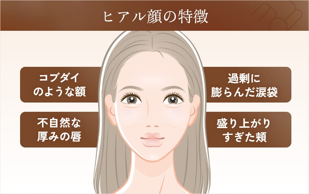 ヒアルロン酸フェイス