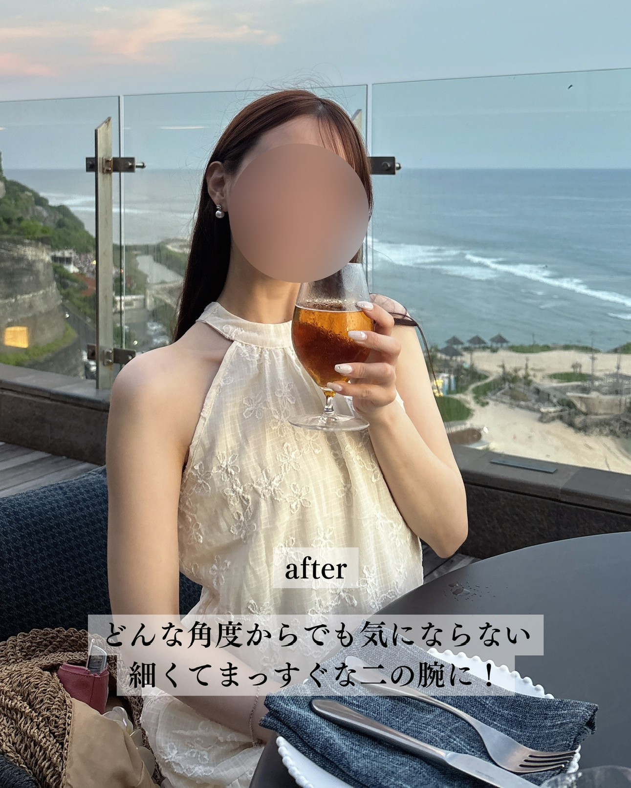 二の腕脂肪吸引ー症例写真