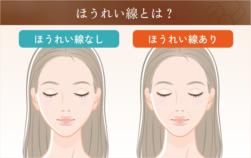 ほうれい線がある顔とない顔の比較