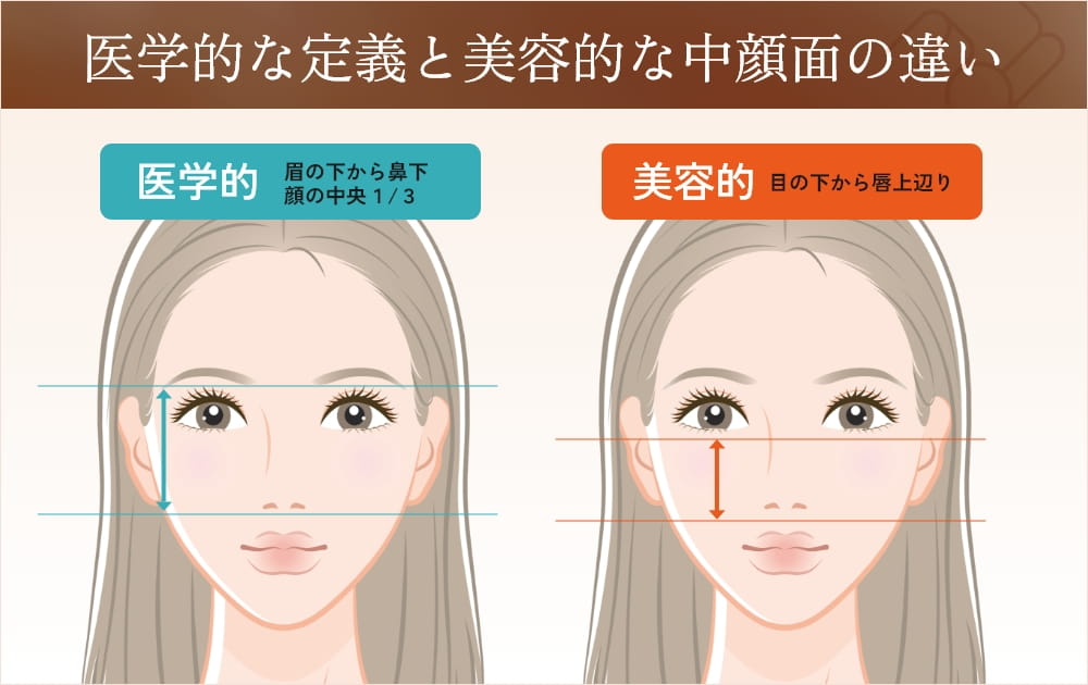 顔の医学的・美容的な中顔面の違いの図