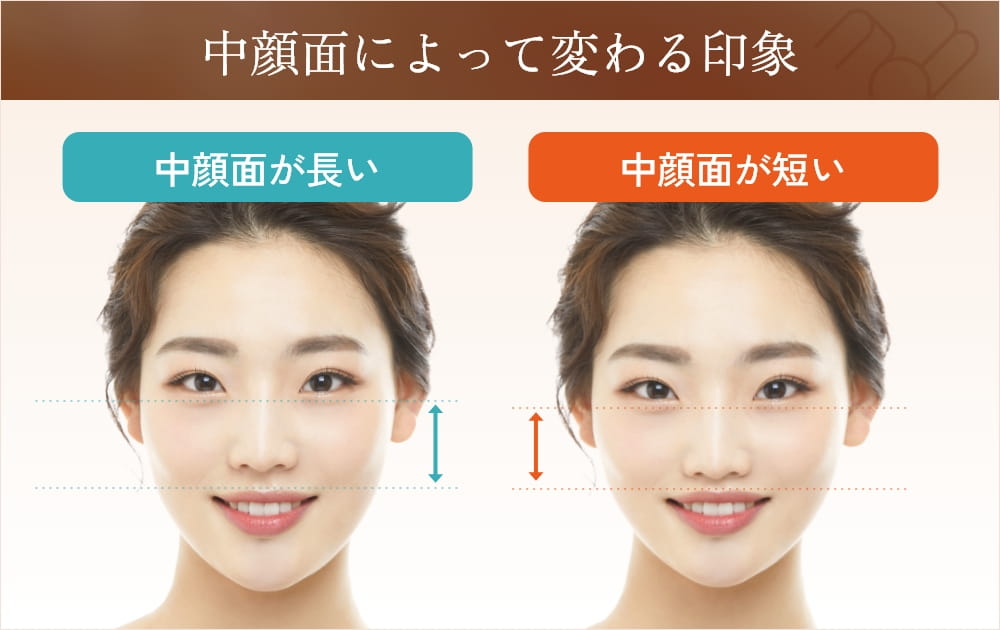 中顔面が長い女性と短い女性の顔の比較