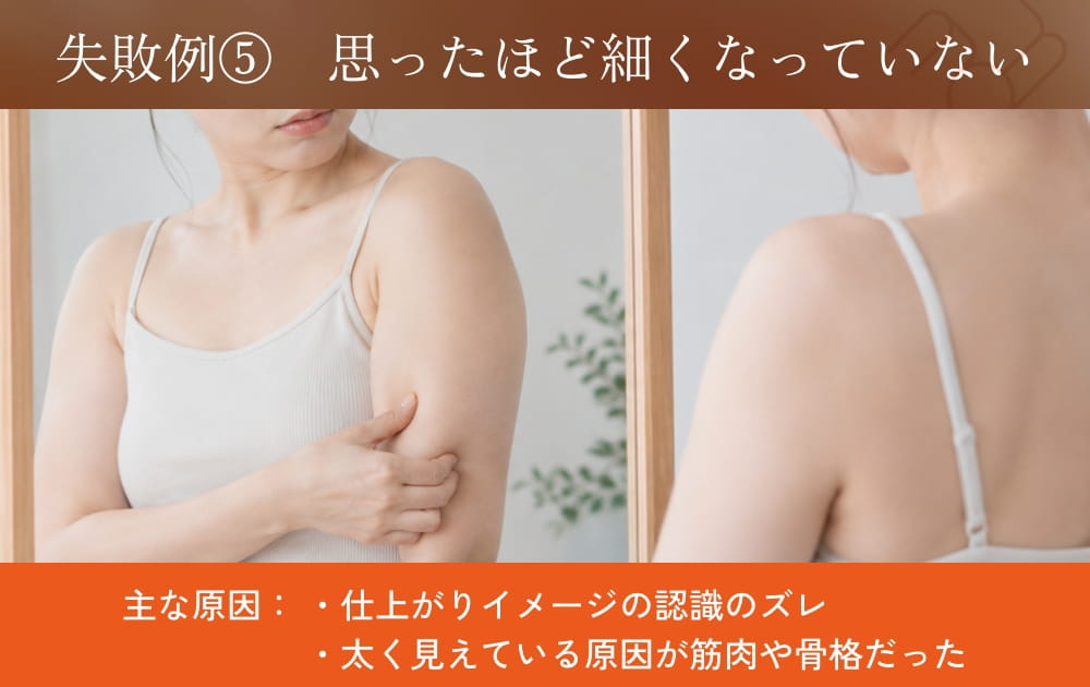 腕の脂肪を掴む女性の鏡像