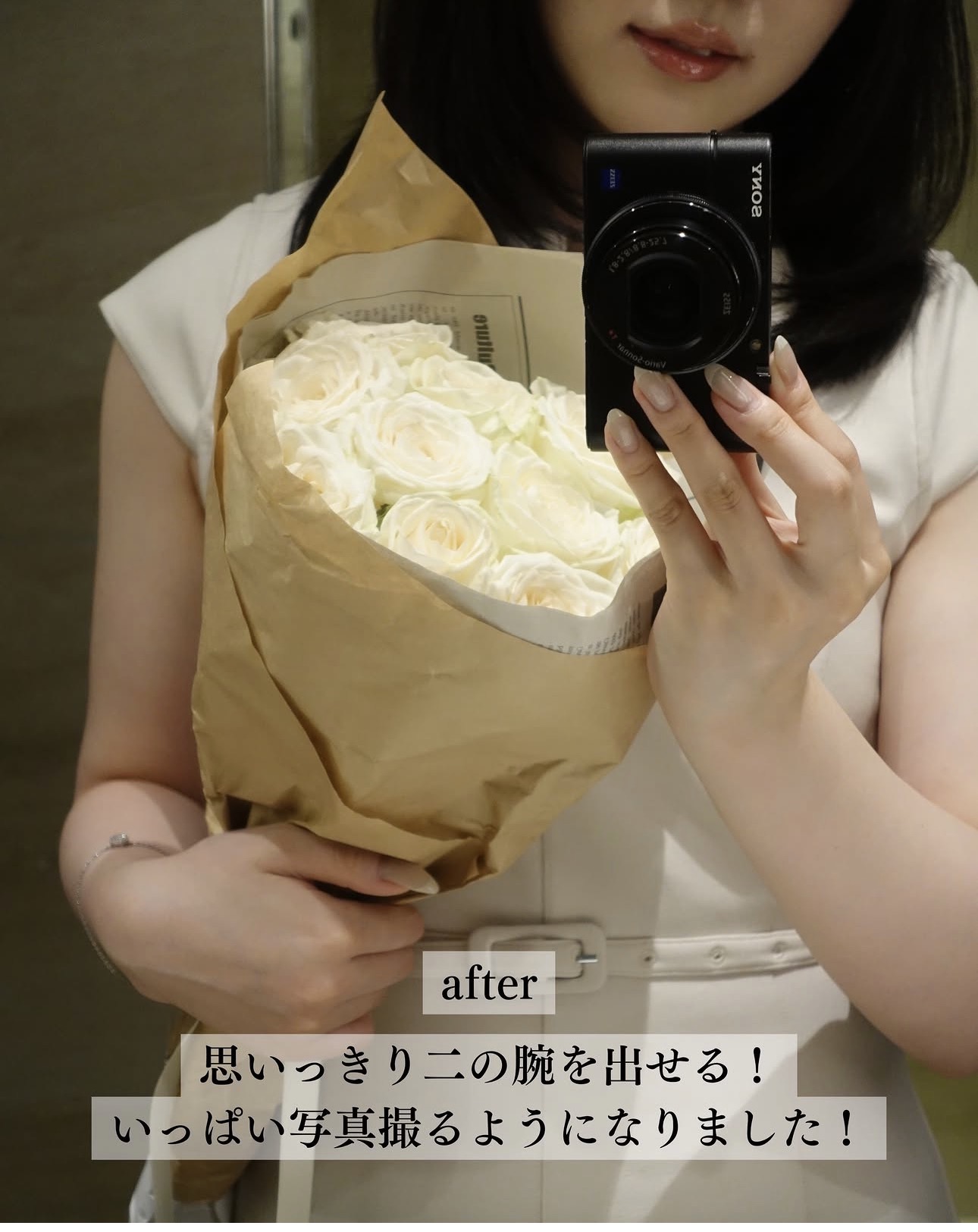 二の腕脂肪吸引ー症例写真