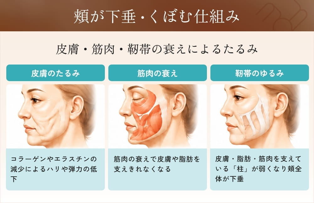 頬のたるみの原因となる3つの要因の比較図