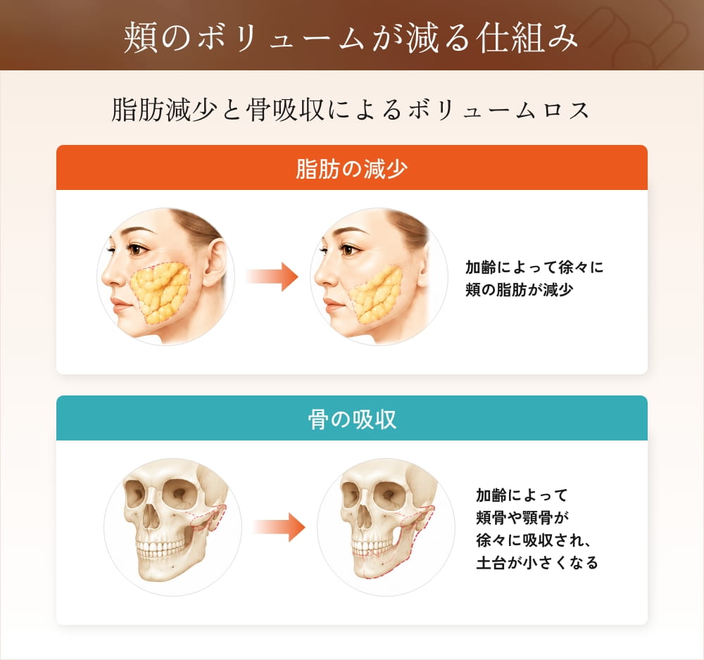 顔の脂肪減少と骨吸収によるボリュームロス