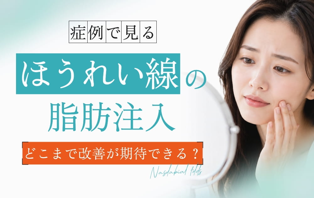 ほうれい線の脂肪注入の文字と笑顔の女性